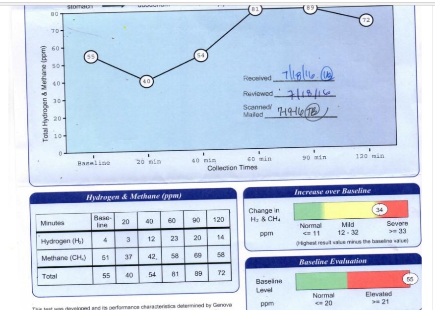 sibo-test-results